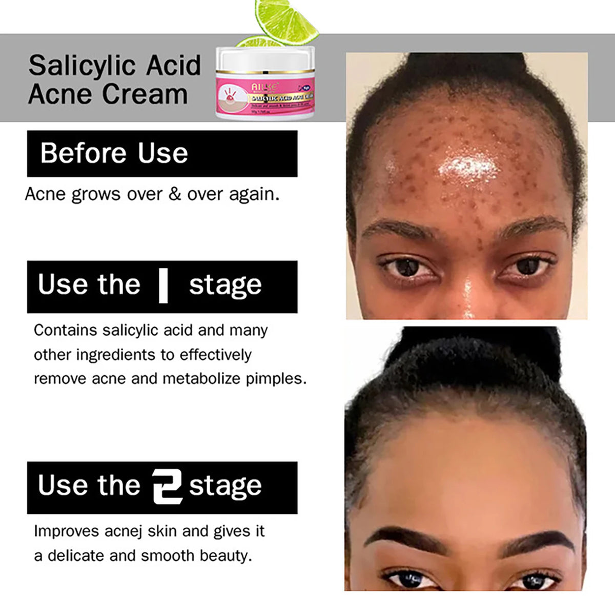 AILKE Niacinamide Brightening And Moisturizing Skin Cream