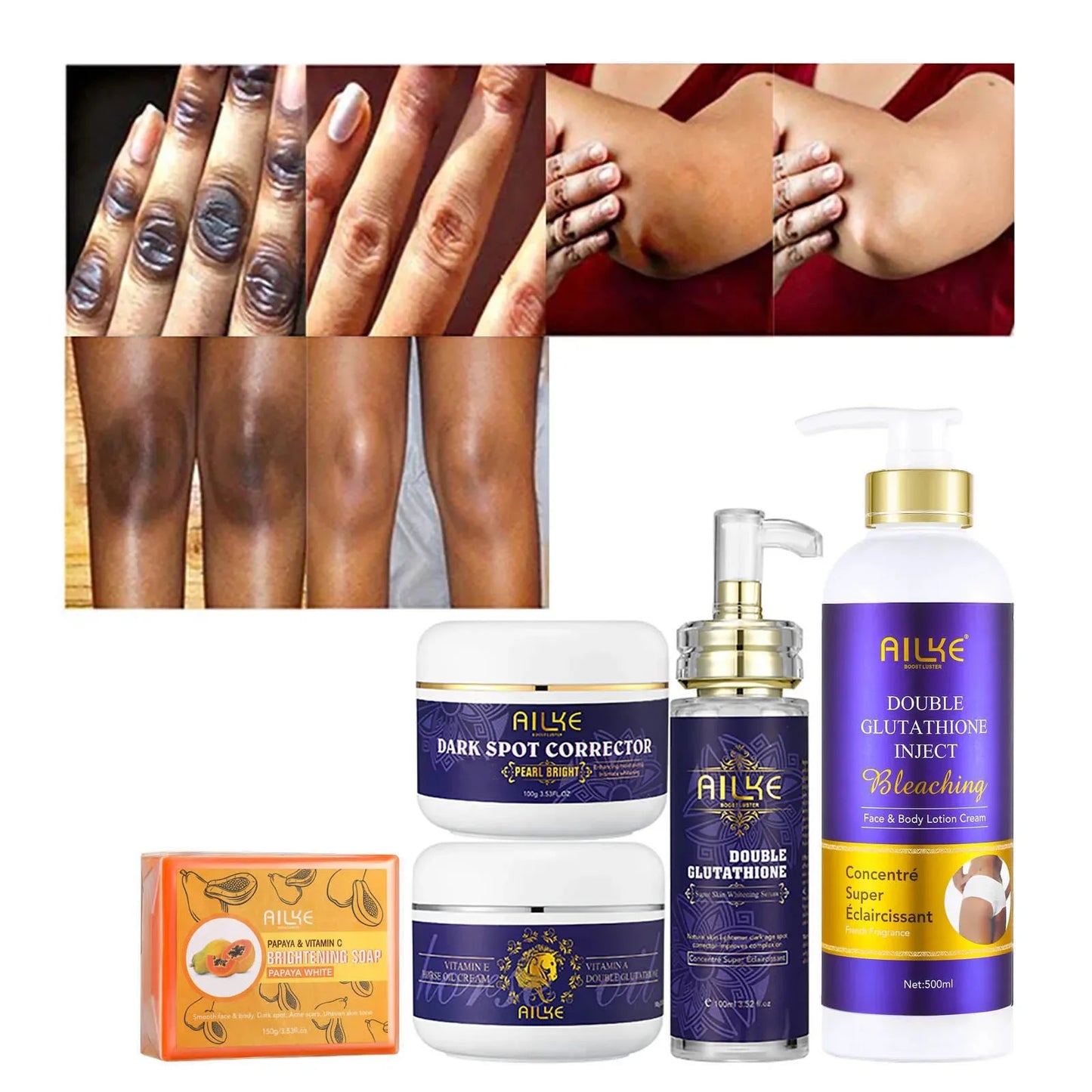 AILKE Glutathione 5-in-1 Women Skin Care Kit, With Body Lotion, Serum, Dark Spot Removal Cream, Body Cream, Brightening Soap