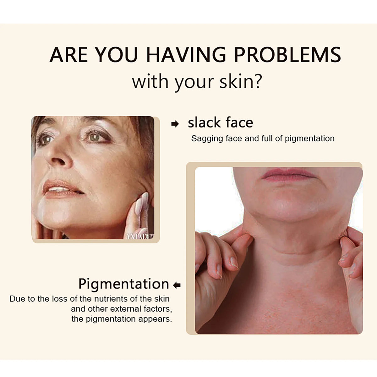 Kyliefit Collagen Whitening Essence For Facial And Body Brightening Cream